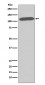 Anti-CD26/DPP4 Rabbit Monoclonal Antibody